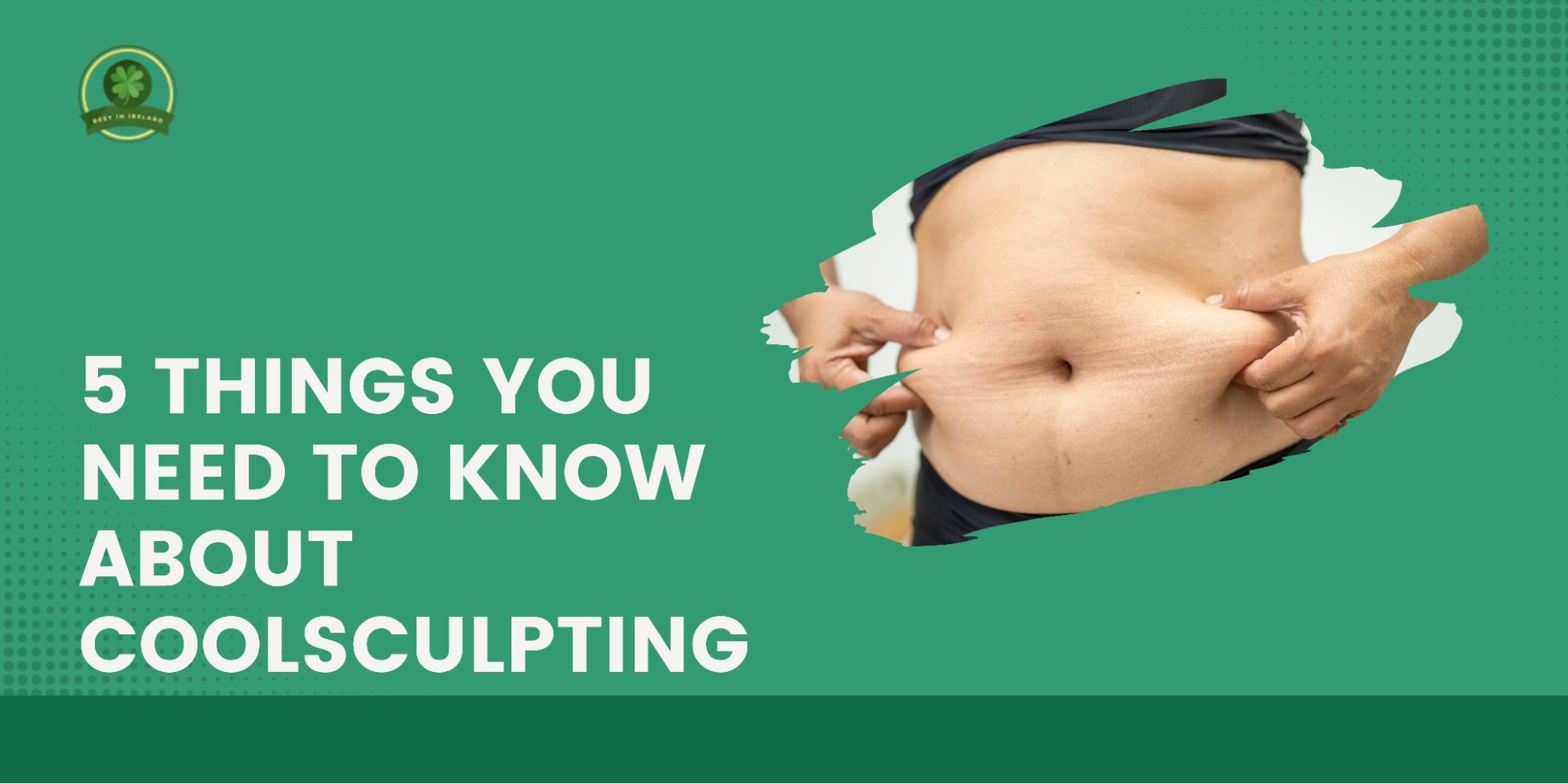 5 Things You Need to Know About Coolsculpting