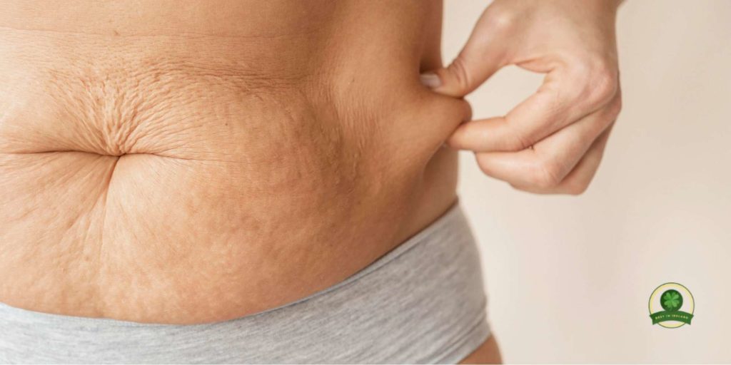 Coolsculpting is not meant to fix sagging skin