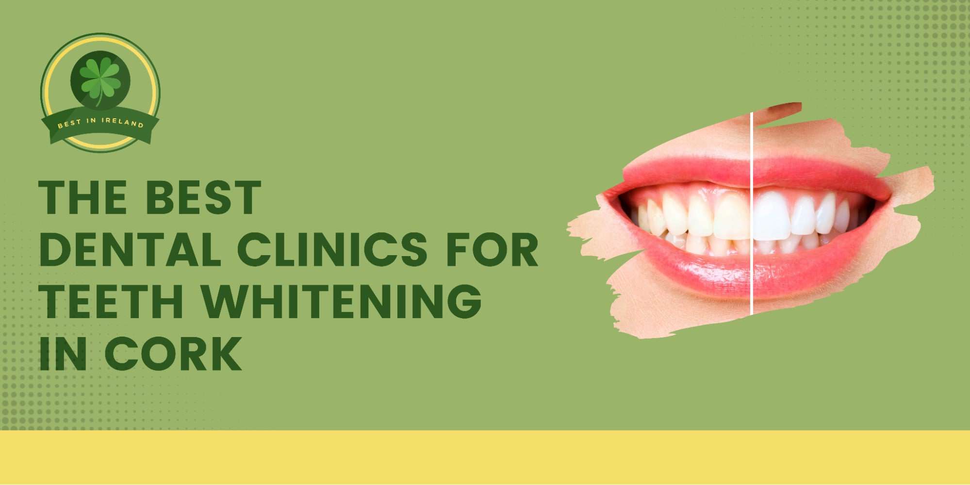 The 5 Best Dental Clinics for Teeth Whitening in Cork