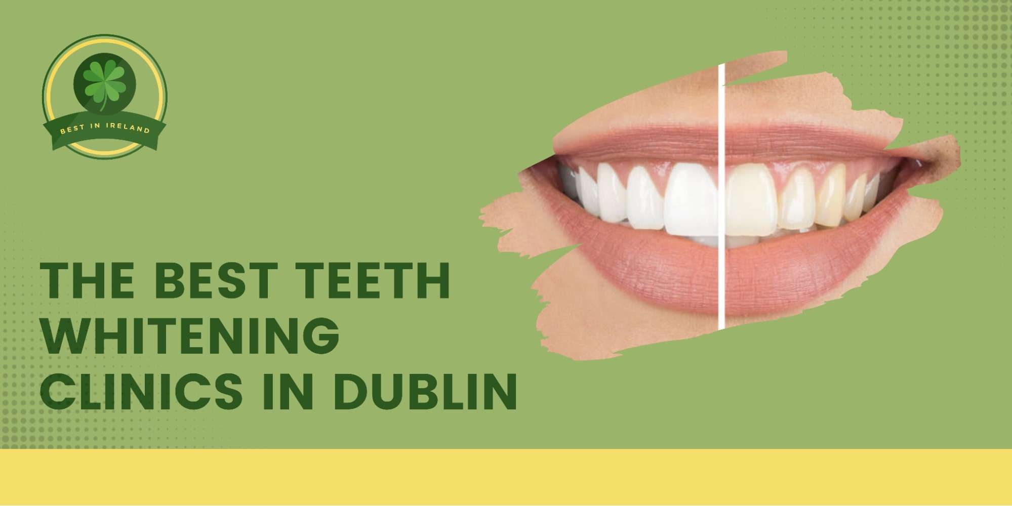 The 5 Best Teeth Whitening Clinics in Dublin