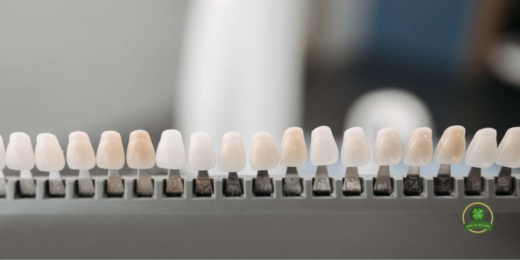 What are dental veneers