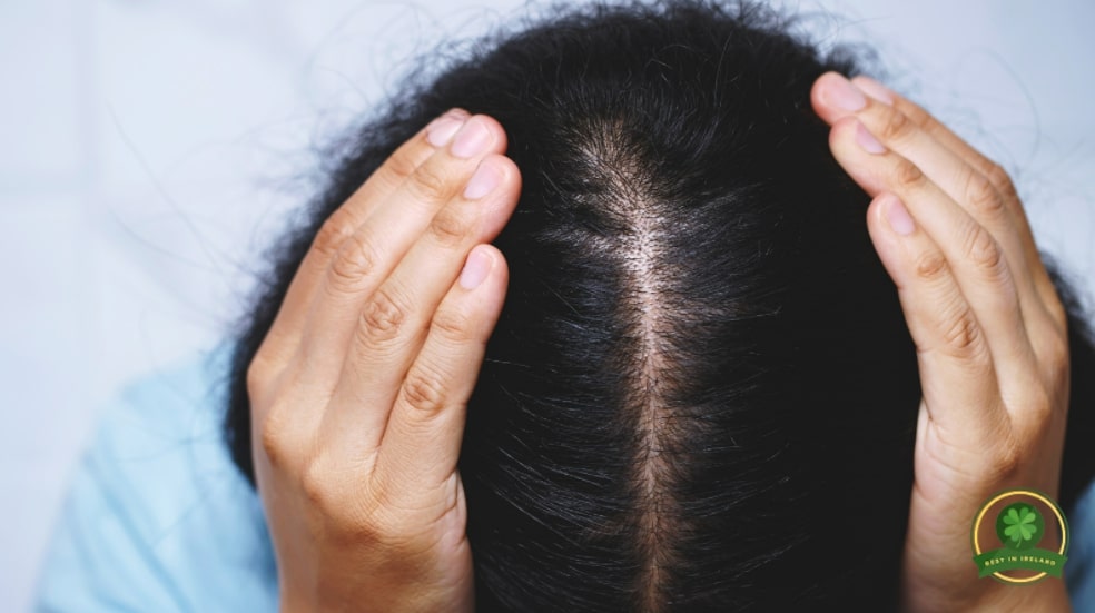 What is a hair transplant