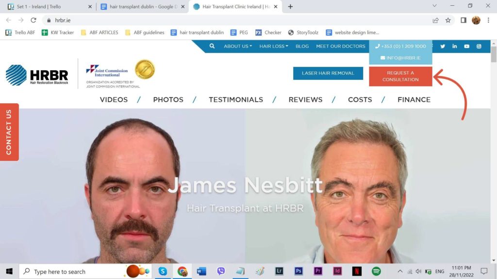 Hair Restoration Blackrock (HRBR)'s Homepage